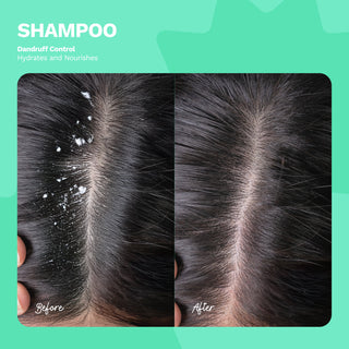 Shampoo Dandruff Control - Hydrates and Nourishes | BE FREE | 8 OZ / 240 ML - Ginger Milk Natural Care