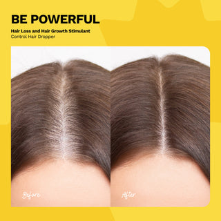 Hair Loss and Hair Growth Stimulant Control Hair Dropper | BE POWERFUL - Ginger Milk Natural Care